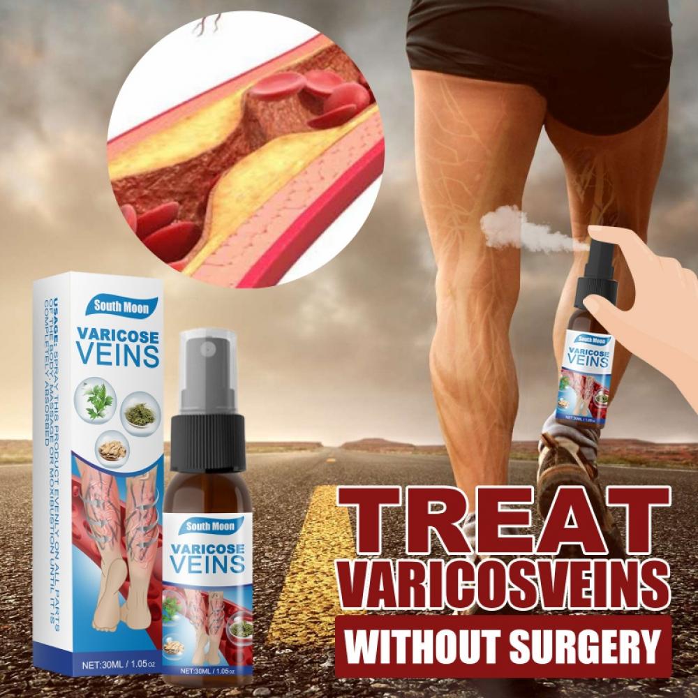 Vein Treatment Varicose Vein Treatment Spray, Leg Varicose Vein Treatment